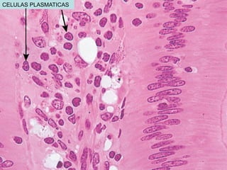 CELULAS PLASMATICAS
 
