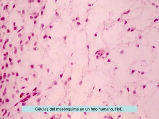 Células del mesénquima en un feto humano, HyE.
 