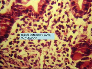 TEJIDO CONECTIVO LAXO
MUY CELULAR
 