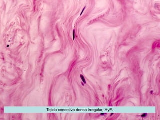 Tejido conectivo denso irregular, HyE.
 