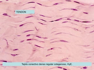 TENDON




   Tejido conectivo denso regular colagenoso, HyE.
 