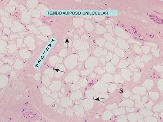 TEJIDO ADIPOSO UNILOCULAR
 