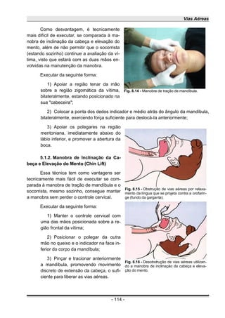 Vias Aéreas
Como desvantagem, é tecnicamente
mais difícil de executar, se comparada à ma-
nobra de inclinação da cabeça e elevação do
mento, além de não permitir que o socorrista
(estando sozinho) continue a avaliação da ví-
tima, visto que estará com as duas mãos en-
volvidas na manutenção da manobra.
Executar da seguinte forma:
1) Apoiar a região tenar da mão
sobre a região zigomática da vítima,
bilateralmente, estando posicionado na
sua "cabeceira";
2) Colocar a ponta dos dedos indicador e médio atrás do ângulo da mandíbula,
bilateralmente, exercendo força suficiente para deslocá-Ia anteriormente;
3) Apoiar os polegares na região
mentoniana, imediatamente abaixo do
lábio inferior, e promover a abertura da
boca.
5.1.2. Manobra de Inclinação da Ca-
beça e Elevação do Mento (Chin Lift)
Essa técnica tem como vantagens ser
tecnicamente mais fácil de executar se com-
parada à manobra de tração de mandíbula e o
socorrista, mesmo sozinho, consegue manter
a manobra sem perder o controle cervical.
Executar da seguinte forma:
1) Manter o controle cervical com
uma das mãos posicionada sobre a re-
gião frontal da vítima;
2) Posicionar o polegar da outra
mão no queixo e o indicador na face in-
ferior do corpo da mandíbula;
3) Pinçar e tracionar anteriormente
a mandíbula, promovendo movimento
discreto de extensão da cabeça, o sufi-
ciente para liberar as vias aéreas.
- 114 -
Fig. 8.14 - Manobra de tração de mandíbula.
Fig. 8.15 - Obstrução de vias aéreas por relaxa-
mento da língua que se projeta contra a orofarin-
ge (fundo da garganta).
Fig. 8.16 - Desobstrução de vias aéreas utilizan-
do a manobra de inclinação da cabeça e eleva-
ção do mento.
 