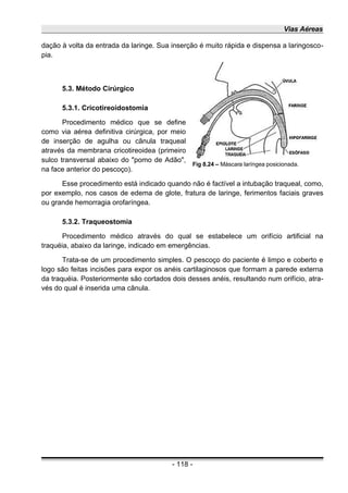 Vias Aéreas
dação à volta da entrada da laringe. Sua inserção é muito rápida e dispensa a laringosco-
pia.
5.3. Método Cirúrgico
5.3.1. Cricotireoidostomia
Procedimento médico que se define
como via aérea definitiva cirúrgica, por meio
de inserção de agulha ou cânula traqueal
através da membrana cricotireoidea (primeiro
sulco transversal abaixo do "pomo de Adão",
na face anterior do pescoço).
Esse procedimento está indicado quando não é factível a intubação traqueal, como,
por exemplo, nos casos de edema de glote, fratura de laringe, ferimentos faciais graves
ou grande hemorragia orofaríngea.
5.3.2. Traqueostomia
Procedimento médico através do qual se estabelece um orifício artificial na
traquéia, abaixo da laringe, indicado em emergências.
Trata-se de um procedimento simples. O pescoço do paciente é limpo e coberto e
logo são feitas incisões para expor os anéis cartilaginosos que formam a parede externa
da traquéia. Posteriormente são cortados dois desses anéis, resultando num orifício, atra-
vés do qual é inserida uma cânula.
- 118 -
Fig 8.24 – Máscara laríngea posicionada.
 