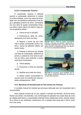 Vias Aéreas
4.2.2.2. Compressão Torácica
A compressão torácica é utilizada
quando a compressão abdominal é inviável
ou contra-indicada, como nos casos de obesi-
dade com circunferência abdominal muito lar-
ga e gestação próxima do termo. Consciente
em uma série de quatro compressões toráci-
cas sobre o terço inferior do esterno, logo aci-
ma do apêndice xifóide.
● Vítima em pé ou sentada:
1) Posicionar-se atrás da vítima,
abraçando-a em torno do tórax;
2) Segurar o punho da sua outra
mão e aplicar compressão contra o es-
terno, acima do apêndice xifóide, por
quatro vezes;
3) Estando a vítima em pé, ampliar
sua base de sustentação, afastando as
pernas, e posicionar uma entre as per-
nas da vítima, para evitar-lhe a queda
caso fique inconsciente.
● Vítima deitada:
1) Posicionar a vítima em decúbito
dorsal;
2) Ajoelhar-se ao lado da vítima;
3) Aplicar quatro compressões to-
rácicas como na manobra de ressusci-
tação cardiopulmonar - RCP;
4.2.3. Manobras de Desobstrução de Vias Aéreas em Crianças
A remoção manual de material que provoque obstrução sem ser visualizado não é
recomendada.
Para crianças maiores de um ano, aplicar a manobra de Heimlich, de forma seme-
lhante à do adulto; nos lactentes, uma combinação de palmada nas costas (face da crian-
ça voltada para baixo) e compressões torácicas (face voltada para cima), sempre apoian-
do a vítima no seu antebraço; mantenha-o com a cabeça mais baixa que o tronco, próxi-
mo a seu corpo.
- 112 -
Fig. 8.9 - Após a vítima ter ficado inconsciente
durante a manobra de Heimlich, rapidamente o
socorrista a deposita sobre o solo para, caso não
tenha ocorrido a desobstrução das vias aéreas,
dar início ás compressões torácicas.
Fig. 8.10 - O socorrista, após constatar que as
vias aéreas continuam obstruídas, dá início às
compressões torácicas.
 