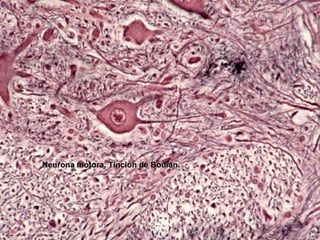 Neurona motora. Tinción de Bodian.
 