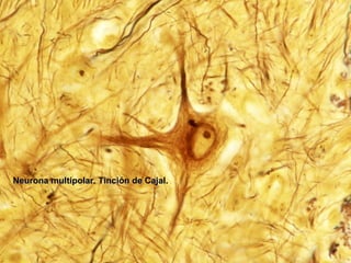 Neurona multipolar. Tinción de Cajal.
 