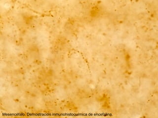 Mesencéfalo. Demostración inmunohistoquímica de encefalina.
 