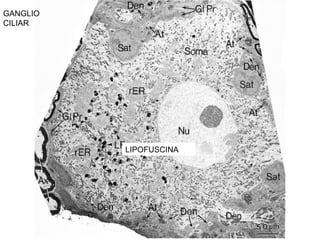 GANGLIO
CILIAR




          LIPOFUSCINA
 