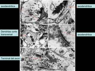 axodendritica       axodendritica




Dendritas corte
transversal         axodendritica




Terminal del axon
 