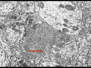 axodendritica
 