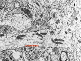 axodendritica
 