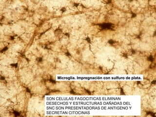 Microglia. Impregnación con sulfuro de plata.




SON CELULAS FAGOCITICAS ELIMINAN
DESECHOS Y ESTRUCTURAS DAÑADAS DEL
SNC SON PRESENTADORAS DE ANTIGENO Y
SECRETAN CITOCINAS
 