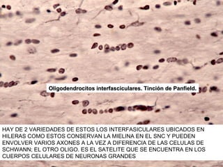 Oligodendrocitos interfasciculares. Tinción de Panfield.




HAY DE 2 VARIEDADES DE ESTOS LOS INTERFASICULARES UBICADOS EN
HILERAS COMO ESTOS CONSERVAN LA MIELINA EN EL SNC Y PUEDEN
ENVOLVER VARIOS AXONES A LA VEZ A DIFERENCIA DE LAS CELULAS DE
SCHWANN; EL OTRO OLIGO. ES EL SATELITE QUE SE ENCUENTRA EN LOS
CUERPOS CELULARES DE NEURONAS GRANDES
 