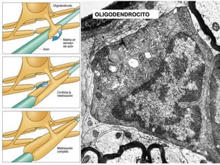 OLIGODENDROCITO
 