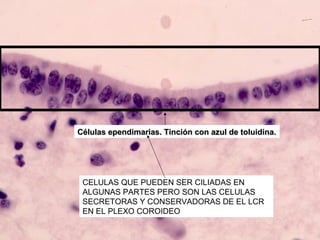 Células ependimarias. Tinción con azul de toluidina.




 CELULAS QUE PUEDEN SER CILIADAS EN
 ALGUNAS PARTES PERO SON LAS CELULAS
 SECRETORAS Y CONSERVADORAS DE EL LCR
 EN EL PLEXO COROIDEO
 