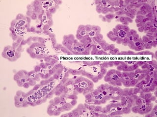 Plexos coroideos. Tinción con azul de toluidina.
 