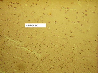 CEREBRO
 