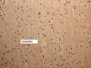 CEREBRO
 