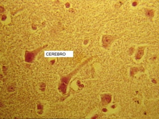 CEREBRO
 
