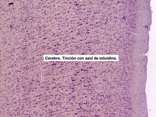 Cerebro. Tinción con azul de toluidina.
 