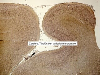 Cerebro. Tinción con gallocianina-cromalo.
 
