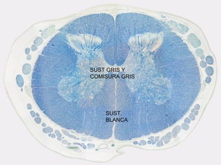 SUST GRIS Y
COMISURA GRIS




    SUST.
    BLANCA
 