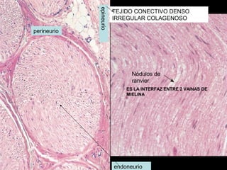 epineurio
                         TEJIDO CONECTIVO DENSO
                         IRREGULAR COLAGENOSO

perineurio




                               Nódulos de
                               ranvier
                             ES LA INTERFAZ ENTRE 2 VAINAS DE
                             MIELINA




                         endoneurio
 