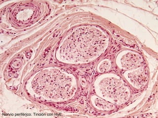 Nervio periférico. Tinción con HyE.
 