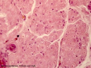 Nervio periférico. Tinción con HyE.
 
