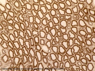 Vainas de mielina en el nervio periférico. Fijación con osmio.
 
