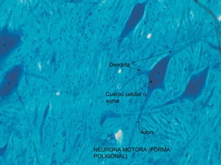 Dendrita




   Cuerpo celular o
   soma




                Axon


NEURONA MOTORA (FORMA
POLIGONAL)
 