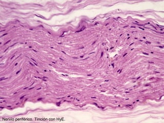 Nervio periférico. Tinción con HyE.
 