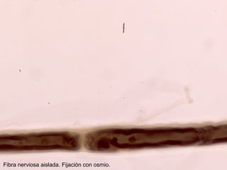 Fibra nerviosa aislada. Fijación con osmio.
 