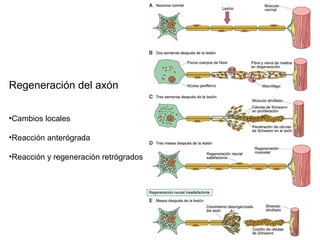 Regeneración del axón


•Cambios locales

•Reacción anterógrada

•Reacción y regeneración retrógrados
 