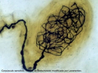 Corpúsculo sensitivo. Tinción de Bielschowski modificada por Laverentiev.
 