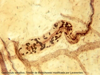 Corpúsculo sensitivo. Tinción de Bielschowski modificada por Laverentiev.
 
