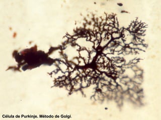 Célula de Purkinje. Método de Golgi.
                              Golgi
 