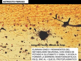 Astrocitos fibrosos. Sublimado de oro de Cajal.
 