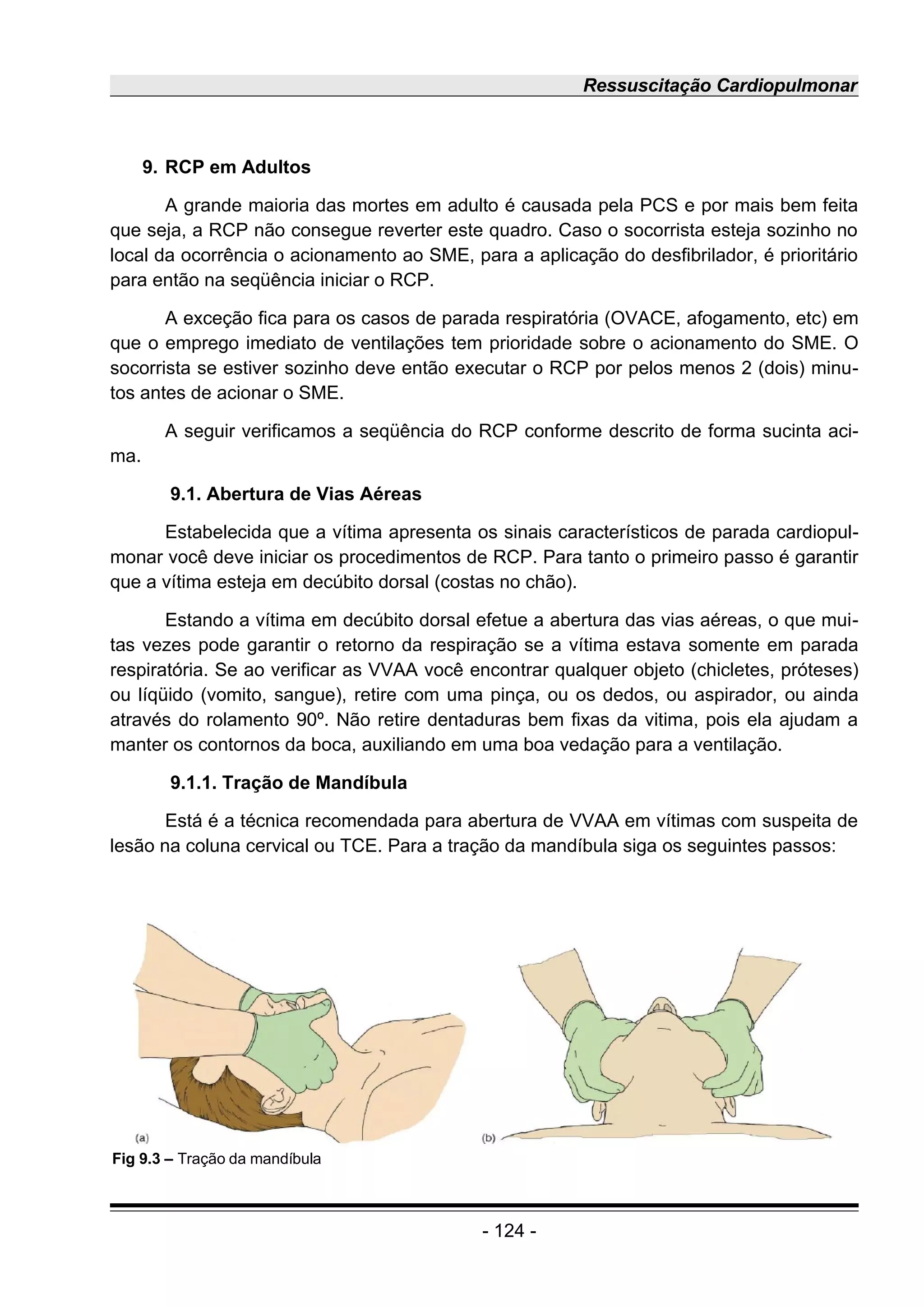 Ressuscitação Cardiopulmonar
9. RCP em Adultos
A grande maioria das mortes em adulto é causada pela PCS e por mais bem feita
que seja, a RCP não consegue reverter este quadro. Caso o socorrista esteja sozinho no
local da ocorrência o acionamento ao SME, para a aplicação do desfibrilador, é prioritário
para então na seqüência iniciar o RCP.
A exceção fica para os casos de parada respiratória (OVACE, afogamento, etc) em
que o emprego imediato de ventilações tem prioridade sobre o acionamento do SME. O
socorrista se estiver sozinho deve então executar o RCP por pelos menos 2 (dois) minu-
tos antes de acionar o SME.
A seguir verificamos a seqüência do RCP conforme descrito de forma sucinta aci-
ma.
9.1. Abertura de Vias Aéreas
Estabelecida que a vítima apresenta os sinais característicos de parada cardiopul-
monar você deve iniciar os procedimentos de RCP. Para tanto o primeiro passo é garantir
que a vítima esteja em decúbito dorsal (costas no chão).
Estando a vítima em decúbito dorsal efetue a abertura das vias aéreas, o que mui-
tas vezes pode garantir o retorno da respiração se a vítima estava somente em parada
respiratória. Se ao verificar as VVAA você encontrar qualquer objeto (chicletes, próteses)
ou líqüido (vomito, sangue), retire com uma pinça, ou os dedos, ou aspirador, ou ainda
através do rolamento 90º. Não retire dentaduras bem fixas da vitima, pois ela ajudam a
manter os contornos da boca, auxiliando em uma boa vedação para a ventilação.
9.1.1. Tração de Mandíbula
Está é a técnica recomendada para abertura de VVAA em vítimas com suspeita de
lesão na coluna cervical ou TCE. Para a tração da mandíbula siga os seguintes passos:
- 124 -
Fig 9.3 – Tração da mandíbula
 