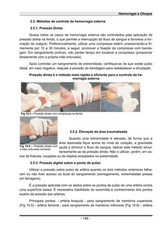 Hemorragia e Choque
2.5. Métodos de controle da hemorragia externa
2.5.1. Pressão Direta
Quase todos os casos de hemorragia externa são controlados pela aplicação de
pressão direta na ferida, o que permite a interrupção do fluxo de sangue e favorece a for-
mação de coágulo. Preferencialmente, utilizar uma compressa estéril, pressionando-a fir-
memente por 10 a 30 minutos; a seguir, promover a fixação da compressa com banda-
gem. Em sangramento profuso, não perder tempo em localizar a compressa (pressionar
diretamente com a própria mão enluvada).
Após controlar um sangramento de extremidade, certifique-se de que existe pulso
distal; em caso negativo, reajuste a pressão da bandagem para restabelecer a circulação.
Pressão direta é o método mais rápido e eficiente para o controle da he-
morragia externa
2.5.2. Elevação da área traumatizada
Quando uma extremidade é elevada, de forma que a
área lesionada fique acima do nível do coração, a gravidade
ajuda a diminuir o fluxo de sangue. Aplicar este método simul-
taneamente ao da pressão direta. Não o utilizar, porém, em ca-
sos de fraturas, luxações ou de objetos empalados na extremidade.
2.5.3. Pressão digital sobre o ponto de pulso
Utilizar a pressão sobre pulso de artéria quando os dois métodos anteriores falha-
rem ou não tiver acesso ao local do sangramento (esmagamento, extremidades presas
em ferragens).
É a pressão aplicada com os dedos sobre os pontos de pulso de uma artéria contra
uma superfície óssea. É necessária habilidade do socorrista e conhecimento dos pontos
exatos de pressão das artérias.
Principais pontos: - artéria braquial - para sangramento de membros superiores
(Fig 10.5) - artéria femoral - para sangramento de membros inferiores (Fig 10.6) - artéria
- 146 -
Fig 10.3 – Pressão direta com compressa na ferida
Fig 10.4 – Pressão direta com
a mão enluvada na ferida
 