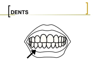 DENTS 