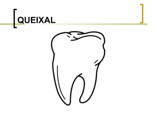 QUEIXAL 