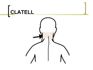 CLATELL 