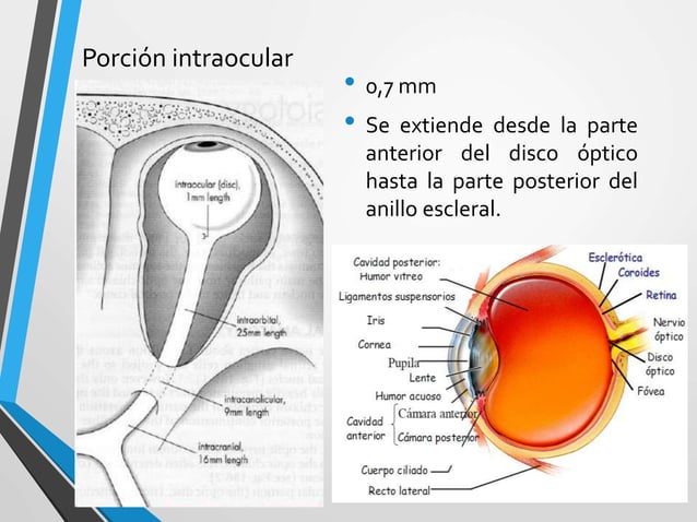 Enfermedades Del Nervio Óptico: Qué Son Y Cómo Se Tratan – QGEGCG