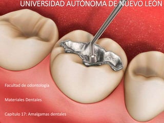 UNIVERSIDAD AUTÓNOMA DE NUEVO LEÓN
Facultad de odontología
Materiales Dentales
Capítulo 17: Amalgamas dentales
 