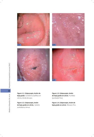 Oncología Ginecológica, Capitulo 1