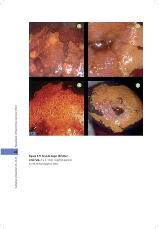 Oncología Ginecológica, Capitulo 1