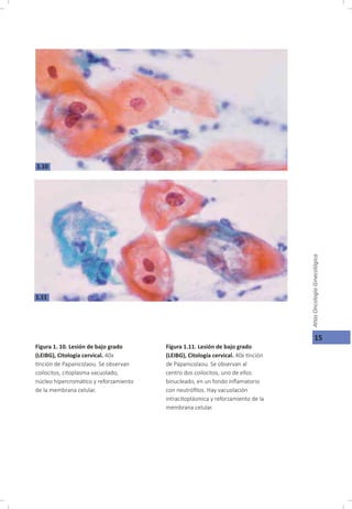 Oncología Ginecológica, Capitulo 1