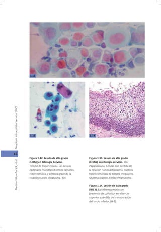 Oncología Ginecológica, Capitulo 1